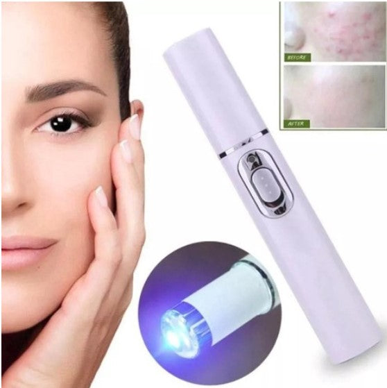 Caneta de laser para tratamento de varizes, acne e cicatriz.