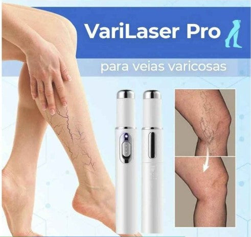 Caneta de laser para tratamento de varizes, acne e cicatriz.